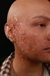SFX Burn Makeup