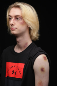 Realistic Black Eyes