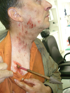Fake Arrow Wound